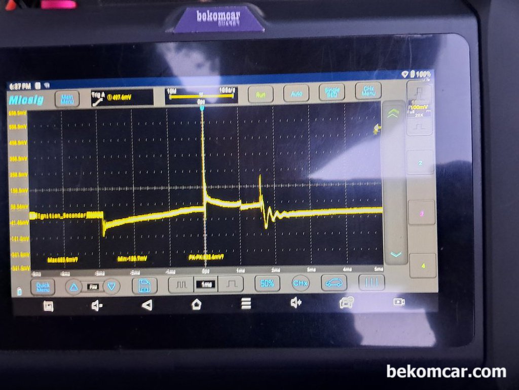점화코일 및 점화플러그 파형분석, 2005년 현대 NF쏘나타 2.0|ベコムカー (bekomcar)