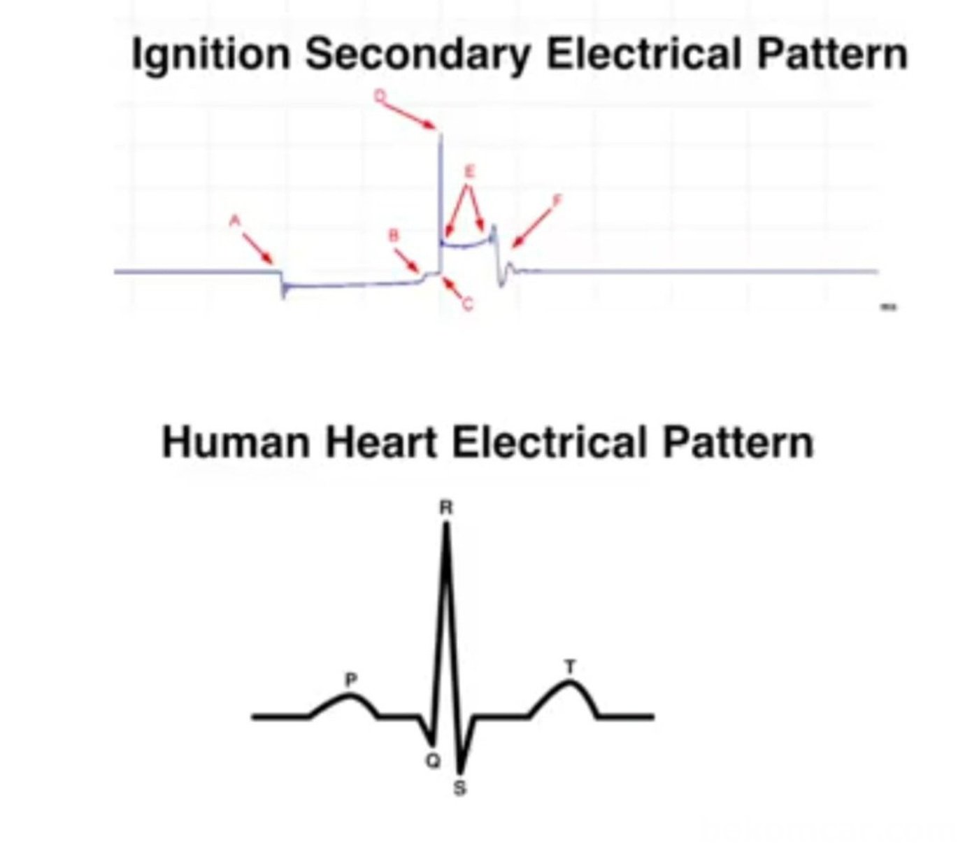 사람심장의 EKG 파형과 차량의 이그니션 파형의 ㅂ교모습이다. Courtesy of DeadOnDiagnostics|بيكومكار  (bekomcar)