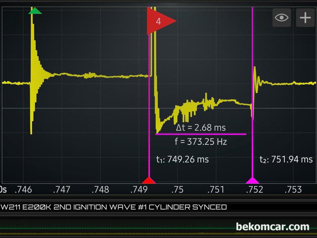 공연비 농후 P0172 와 4번 실린더 실화 P0304 진단과정, 벤츠 W211 E200K|ベコムカー (bekomcar)