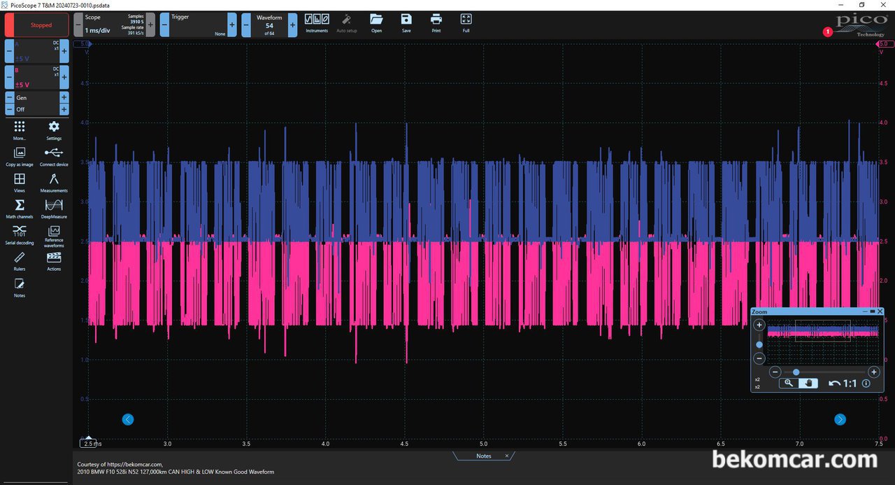 BMW F10 528i CAN통신 (CAN High & Low) 파형분석, 피코스코프 2채널 스코프를 사용하여 캔통신 파형을 측정후 정밀분석을 하였다. 베콤카 캔통신 (CAN High & CAN Low) 파형분석 차량은 BMW F10 528i 차량이다.|ベコムカー (bekomcar)