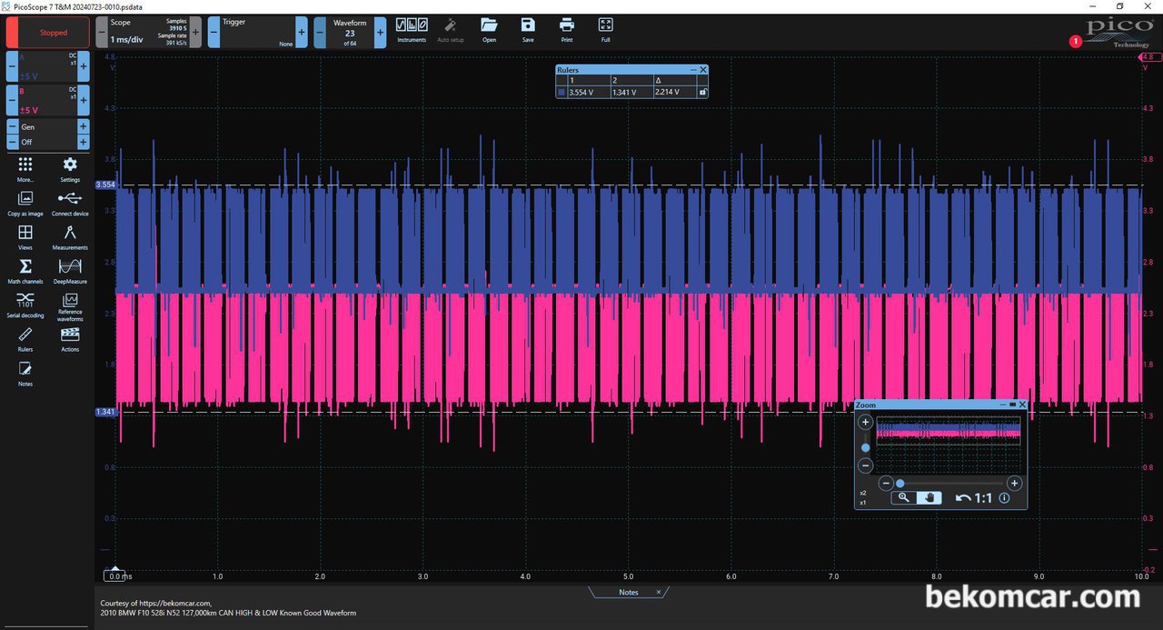 BMW F10 528i CAN통신 (CAN High & Low) 파형분석, F10 528, CD9304 및 20개정도의 고장코드가 스캔된다. 점검과정중에 DME 캔통신 CAN High & Low 통신상태를 점검한다. 일단 캔 통신 High & Low 파형은 정상으로 표시된다. 스코프는 피코스코프 2채널을 사용하였다.|ベコムカー (bekomcar)