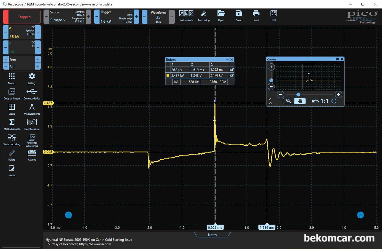 NF쏘나타 점화2차 파형분석으로 점화플러그, 점화코일 인젝터 상태는 정상으로 진단된다, 베콤카 중고차 점검차량은 현대 NF쏘나타 2005년 휘발류 약 19만키로이다. 스코프는 피코스코프 2채널을 사용했다. 점화2차 측정결과 4개 실린더 점화시간은 1.6~1.9ms 정도이며 점화코일 통전시간 (Dwell Time)도 약 2.0ms 정도이다. 플러스 와 마이너스 배선상태도 좋고 점화힘(Firing Voltage)도 2.5kV로 적절하다.|ベコムカー (bekomcar)