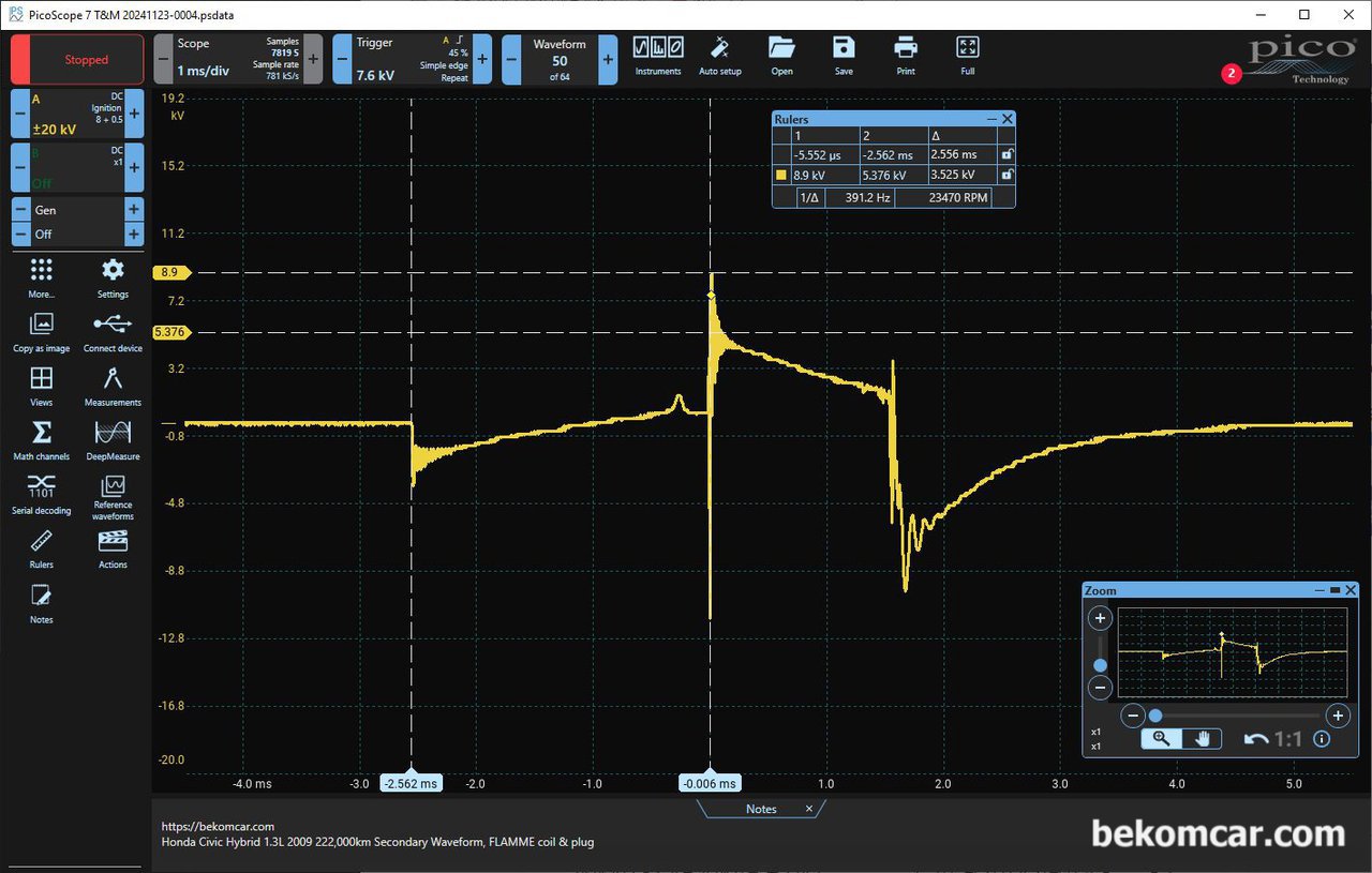 혼다 시빅 하이브리드 2009년 IMA 진단중 특이한 점화파형 기록, 베콤카 진단차량 혼다 시빅의 경우 FLAMME 점화코일과 점화플러그를 사용하는데 실린더별로 점화파형이 상당히 다르다. 이 점화파형도 정상으로 보이지만 확대하여 점화플러그 Burn Time 부분과 점화후 파형을 자세히보면 점화파형이 결코 정상이라고 하기 힘들다.|بيكومكار  (bekomcar)