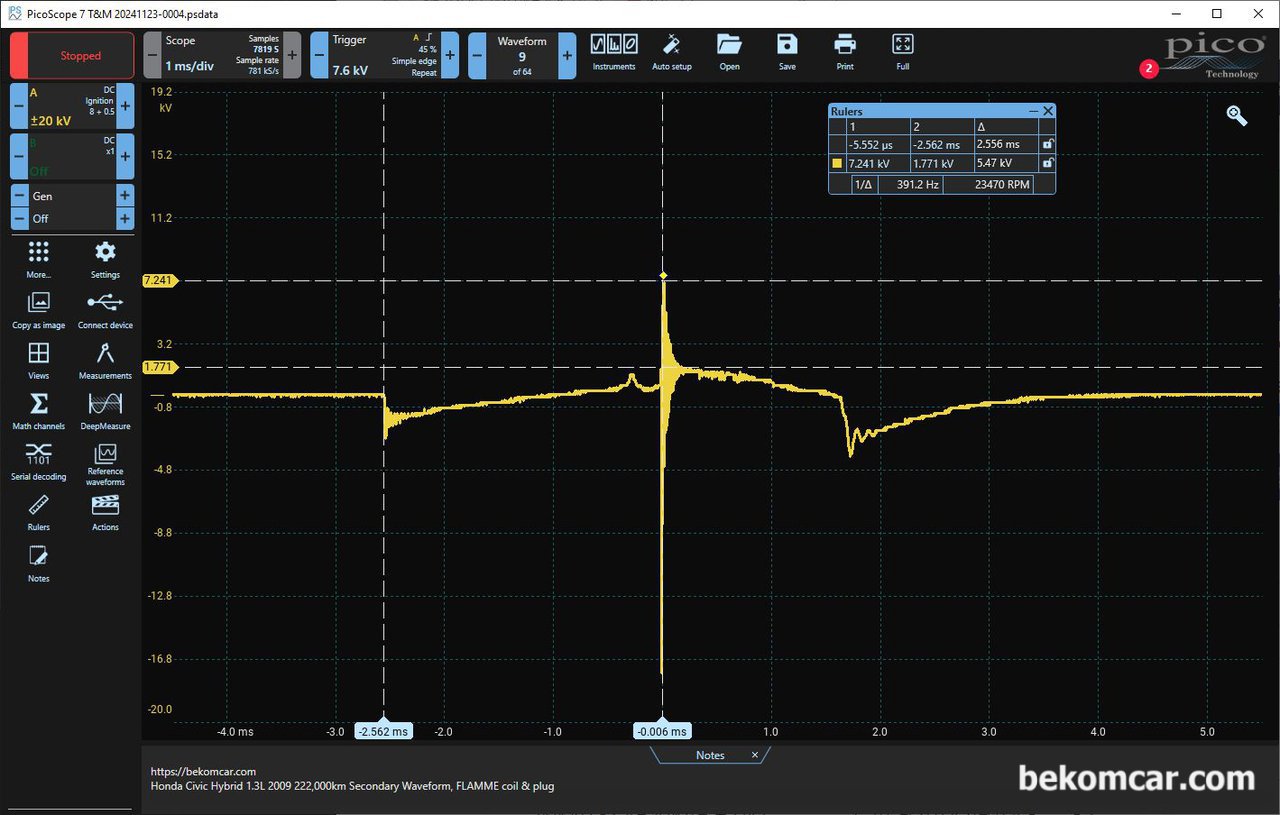 혼다 시빅 하이브리드 2009년 IMA 진단중 특이한 점화파형 기록, 혼다 시빅 2009년 하이브리드 차량 점화2차 파형이다. 점화코일 Dwell Time이 3.0ms가 되지 않는다. 그리고 Firing KV가 약 7.24kV처럼 보인다. 그리고 점화플러그 점화시간(Burn Time, 1.772kV)이 시작되는 시점에 급격하 하강하는 kV가 있다. 사실상 자세히보면 상당히 이상한 점화파형이다. 진단한 시빅의 경우 FLAMME 점화코일과 점화플러그를 사용하고 있다.|بيكومكار  (bekomcar)