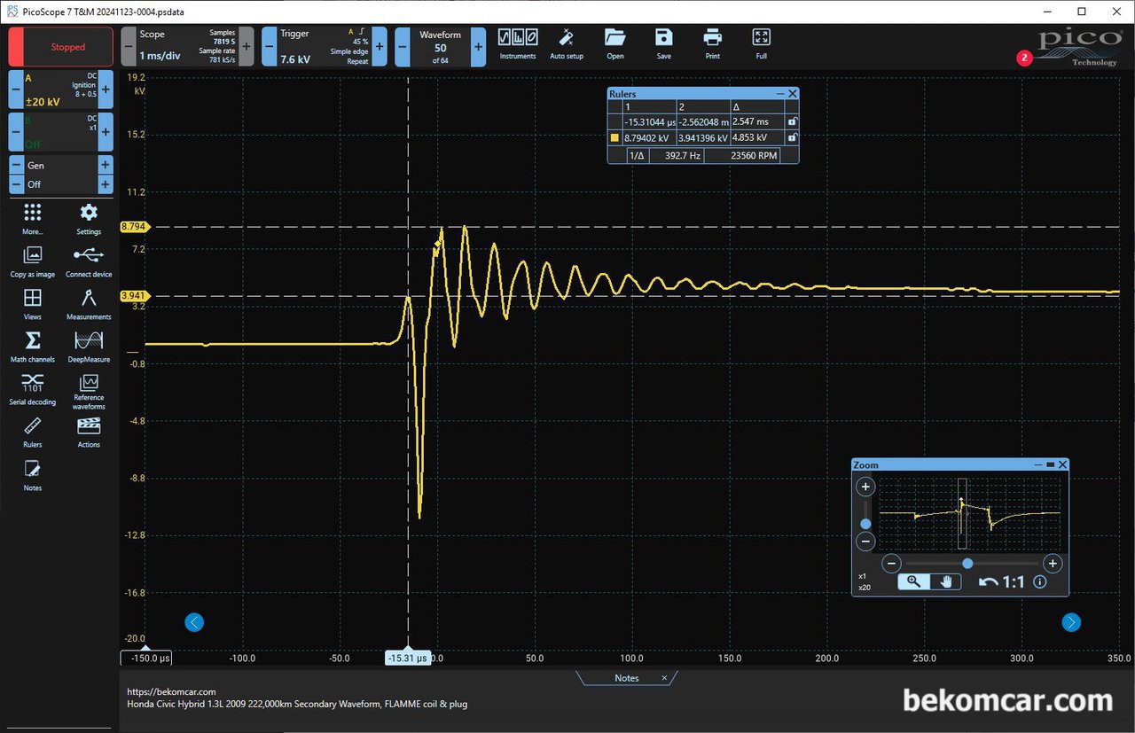 혼다 시빅 하이브리드 2009년 IMA 진단중 특이한 점화파형 기록, 베콤카 진단차량 혼다 시빅의 경우 FLAMME 점화코일과 점화플러그 가 설치되어 있다. 점화플러그 Burn Time 부근을 확대하여보면 사실상 Burning kV가 3.941kV정도로 약 4kV이며 급격한 전압강하와 오슬레이션 파형이 정상과는 많이 다른것 같다.|بيكومكار  (bekomcar)