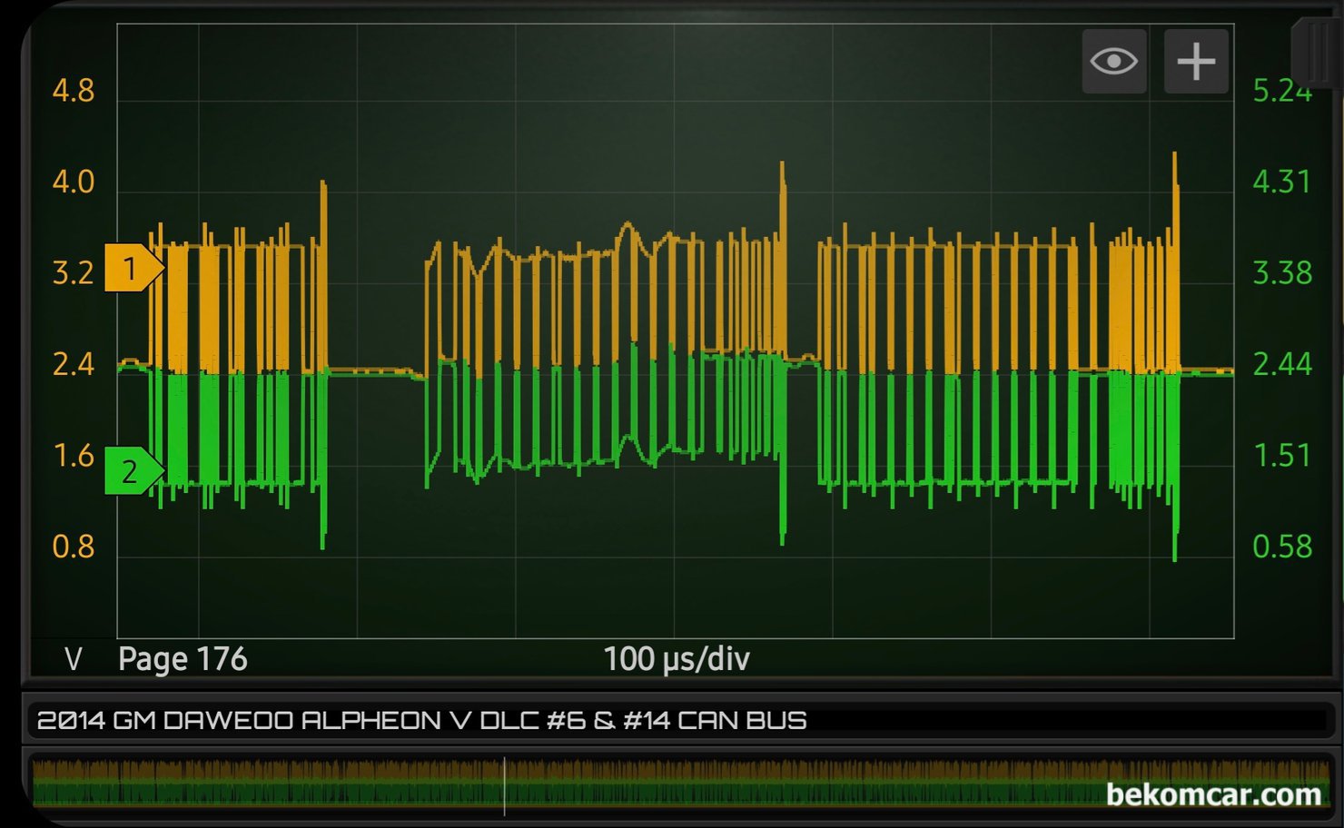 캔 통신이란? 그리고 파형 분석은 어떻게 하는가?, 캔 하이 캔 로우 캔통신 파형을 더 자세히 확대하여 살펴본다. 흠, 경험이 많으면 알 수 있지만 처음 접하면 해갈릴 수 있다.|贝科姆汽车 (bekomcar)