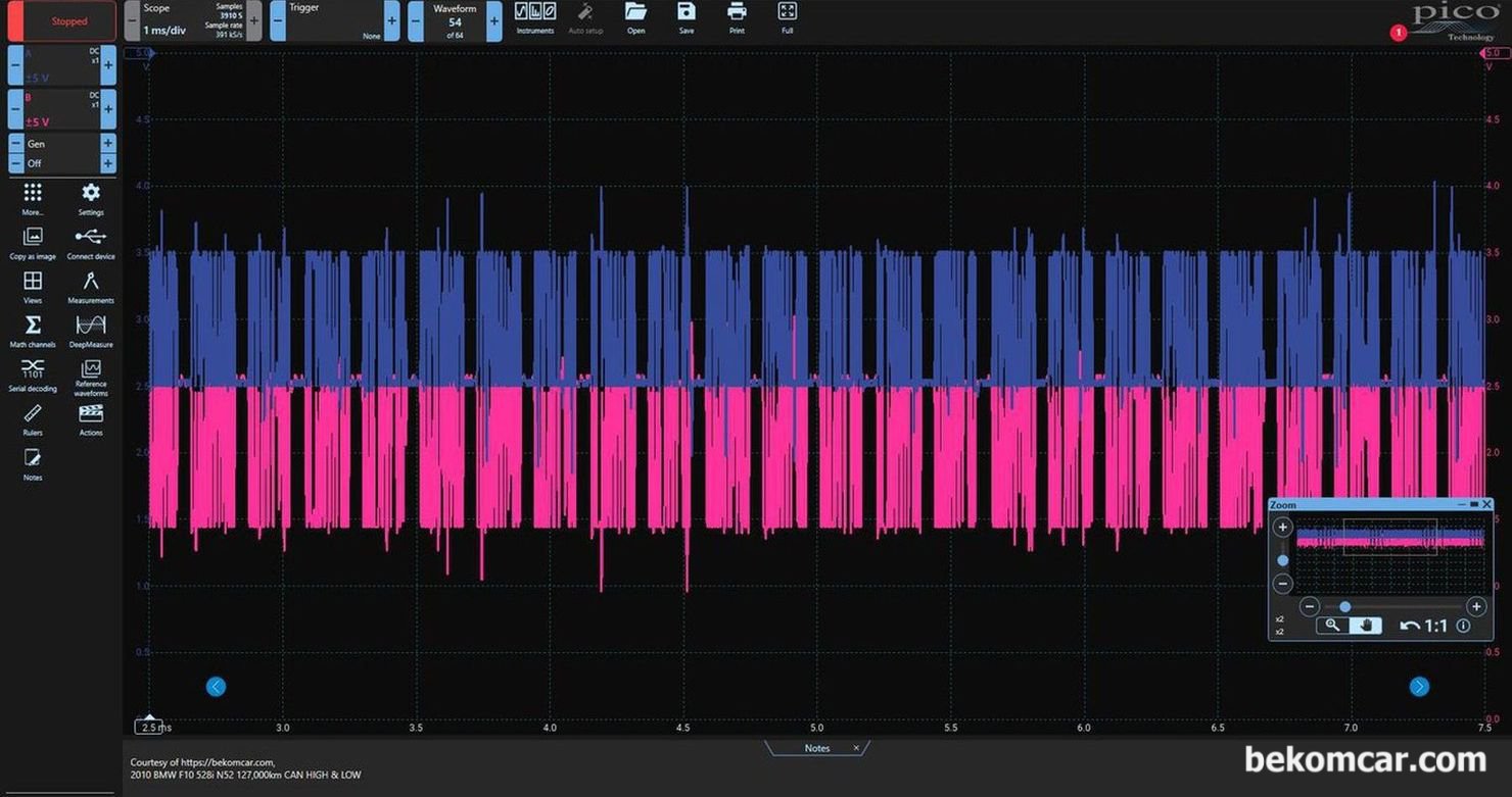 F10 528i CAN High & Low 캔통신 NO ACK 파형, BMW F10 528i 캔 통신 파형은 '무응답, No ACK' 에러이다. 고장 부위는 ABS 모듈이다. 특징은 복사 붙이기 하듯이 파형이 거의 똑 같이 반복되어 측정된다. 모든 고속 캔 통신 데이터 패킷은 수신모듈이 있다. 이러한 수신확인 을 의미하는 ACK 가 없는 경우이다.|贝科姆汽车 (bekomcar)