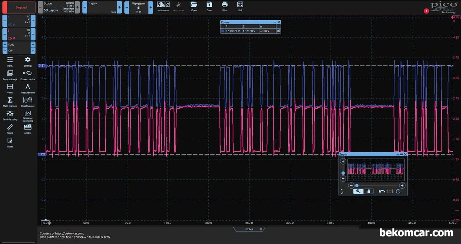 F10 528i CAN High & Low 캔통신 NO ACK 파형, BMW F10 528i ABS 모듈고장 점검 과정이다. NO ACK 의 전형적인 캔 통신 파형이다.|贝科姆汽车 (bekomcar)