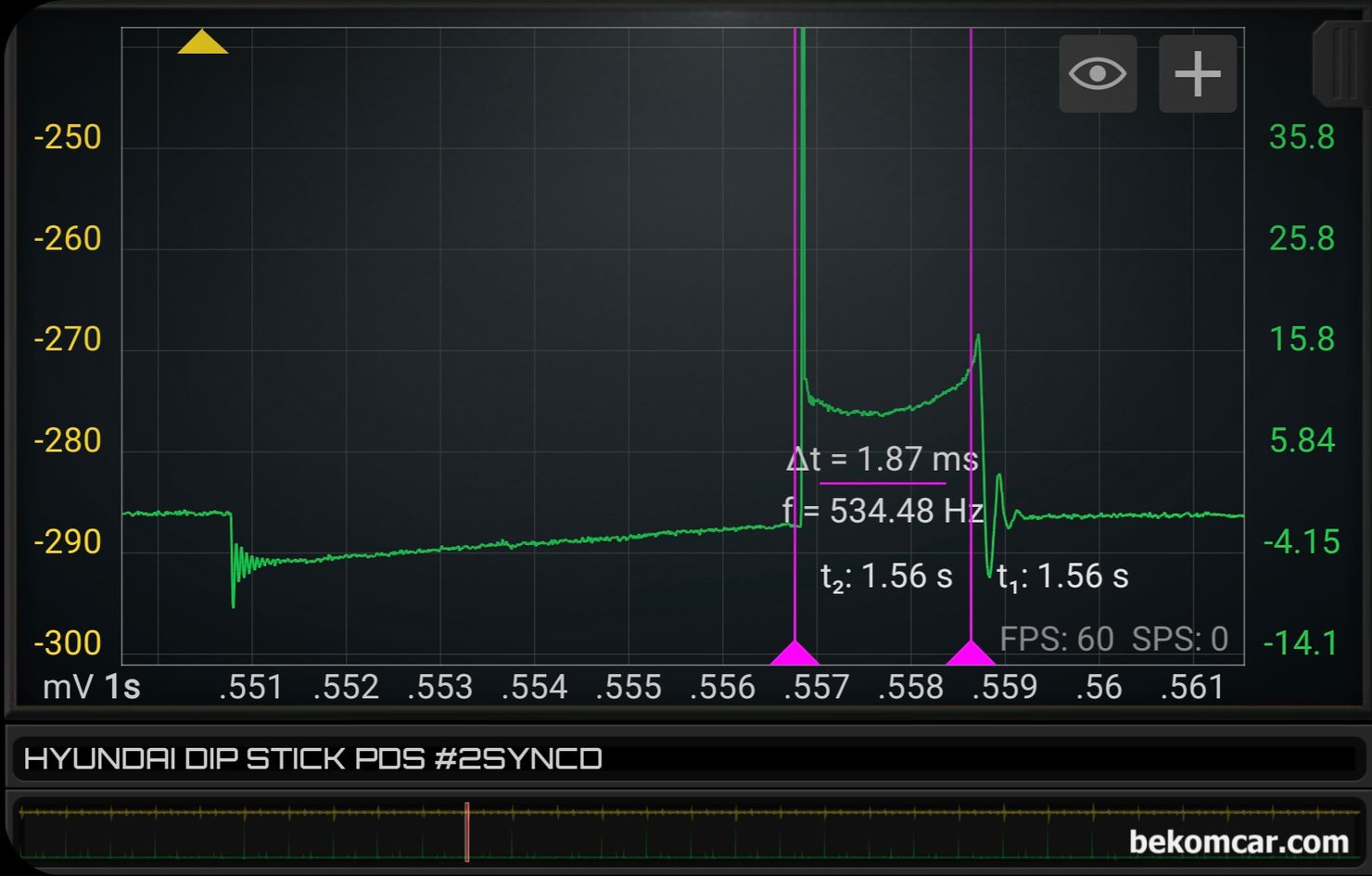 XG 점화파형 과 피스톤링 누설 파형측정 기록, 베콤카 정비인 워크샵과정, 점호코일 작동시간 과 점화 플러그 작동구간 (Burn time) 은 약 1.87ms 정도인데 XG 차량 출시 당시의 PFI 방식 인젝터 시스템에서는 정상적인 작동 시간이다. 플라즈마 포인트도 좋고, 실린더내 공연비나 밸브 상태도 좋다. 점화코일 상태도 좋게 진단 된다. 전체적으로 점화 시스템은 정상 작동중이다.|bekomcar.com